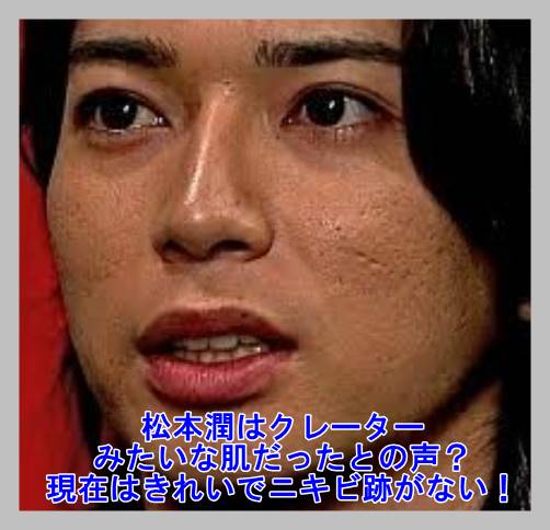画像 松本潤はクレーターみたいな肌だったとの声 現在はきれいでニキビ跡がない